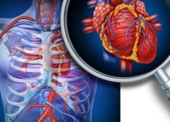 احذر تصلب الشرايين.. أسباب تزيد الإصابة وطرق للوقاية