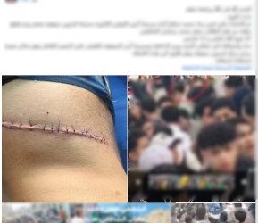 الداخلية تكشف تفاصيل فيديو التعدي على طالب بـ”سلاح أبيض” أمام مدرسة بالمنوفية