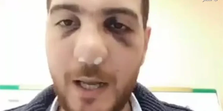 النيابة تقرر إخلاء سبيل طبيب وشاب بكفالة مالية بعد مشاجرة في مستشفى الباجور